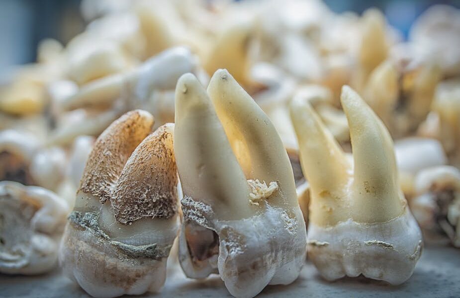 Detailed macro shot of decaying human teeth, showcasing cavity and dental issues.